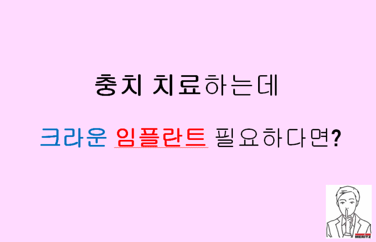  충치 치료하는데 비싼 크라운 임플란트 비용 때문에 걱정된다면?