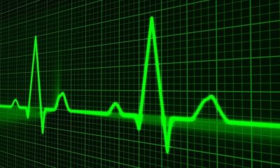  [책 리뷰] "의료인을 위한 ECG" - 심전도의 기초지식