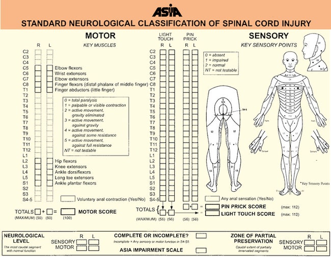 spine 환자 사정 : Neurological examination (ft. ASIA Impairment Scale ...