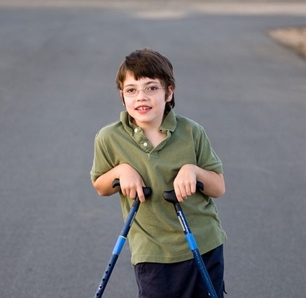 뇌성마비/정상발달 설명해주는 남자 - 뇌성마비 타입별 특징 - 경직형 사지마비(spastic quadriplegia)