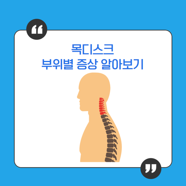  정자역 목디스크 한의원에서 알아보는 부위별 증상과 치료방법