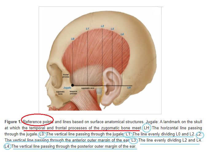 측두근 보톡스( Temporalis Botox) 효과, 주의사항, 부작용에 관하여 : 네이버 블로그
