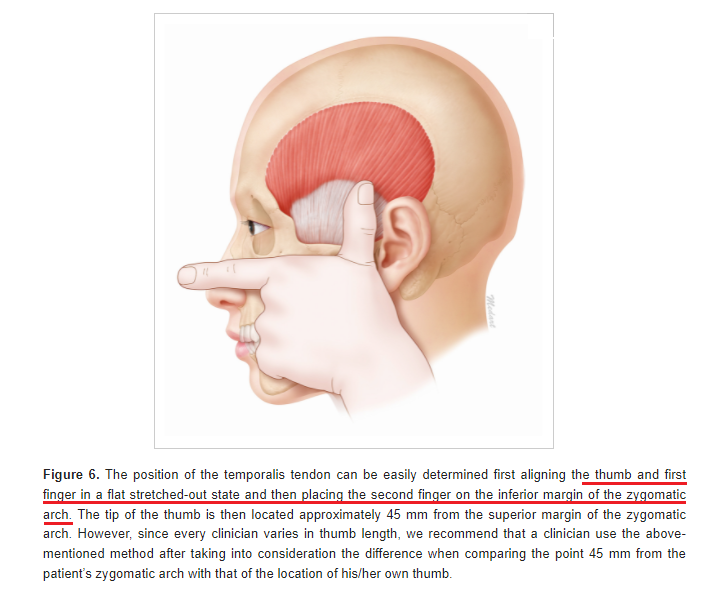 측두근 보톡스( Temporalis Botox) 효과, 주의사항, 부작용에 관하여 : 네이버 블로그