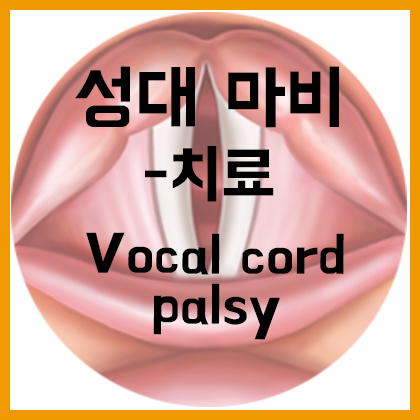  [목] 성대 마비(Vocal cord palsy) - 치료