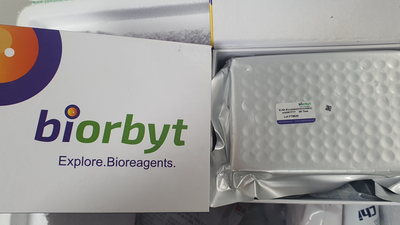 Biorbyt, Rat Estrogen ELISA Kit, orb567777