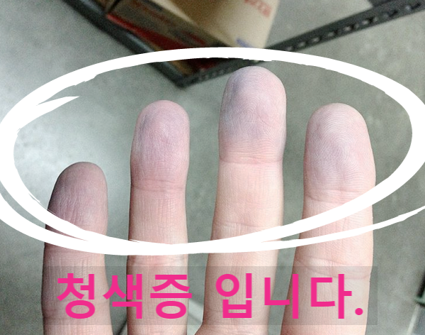 어쩌죠, 지하수 질산성질소 제거 안해, 결국 이런 사단이 났네요. 어쩌죠, 지하수 질산성질소 제거 안해, 결국 이런 사단이 났네요.
