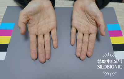  엄마의 아픈 마음 100% 맞춤 손가락의수로 치유해 주세요.