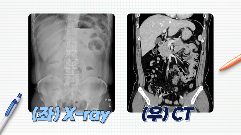 [CT vs MRI 완벽 정리] 영상의학과 전문의가 가르치는 CT와 MRI 검사 원리 [소요시간] 조영제 부작용? 2