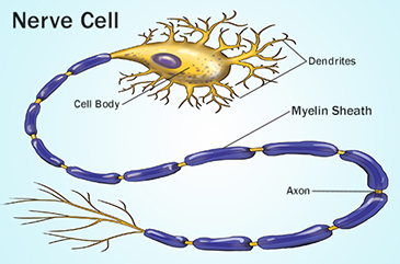 미엘린초(myelin sheath), 미엘린과 신경,  탈수초