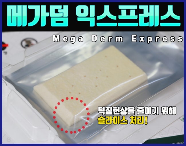 남자성기수술 자연스럽게 메가덤으로 UP UP! : 네이버 블로그 남자성기수술 자연스럽게 메가덤으로 Up Up! : 네이버 블로그