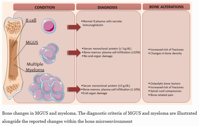 단세포군감마글로불린병증 Monoclonal gammopathy of undetermined significance (MGUS) D472