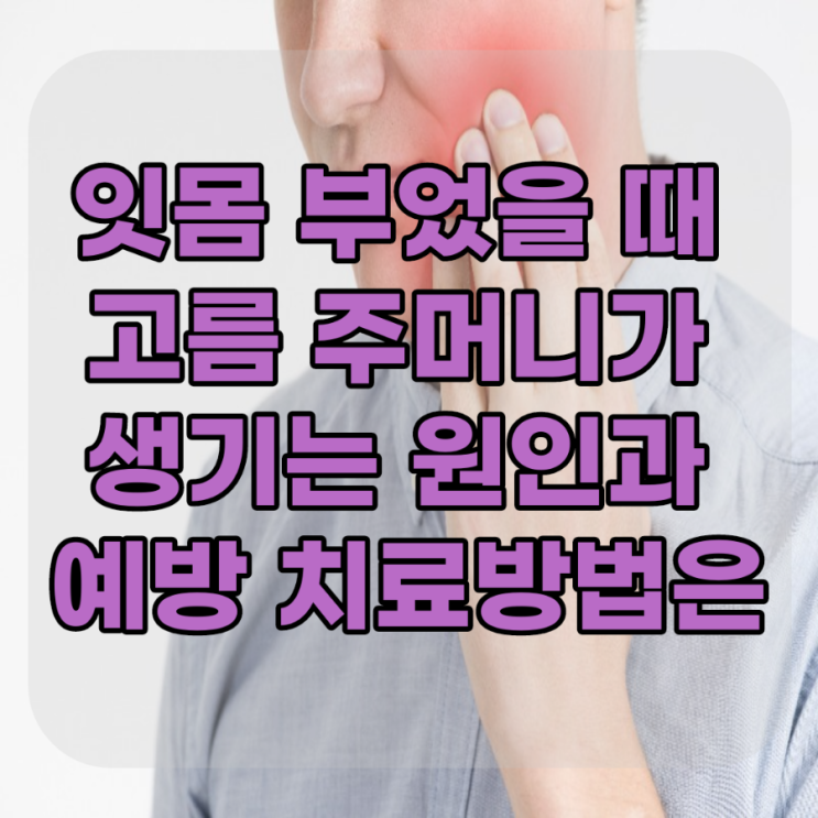  치주 치아 농양 증상 잇몸 부었을 때 고름 주머니가 생기는 원인과 예방 치료방법은