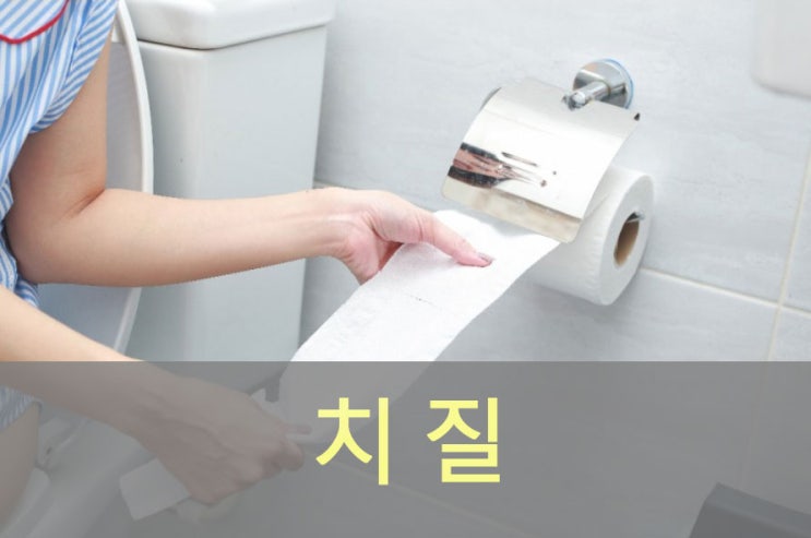  치질 원인과 증상, 예방, 좋은 음식