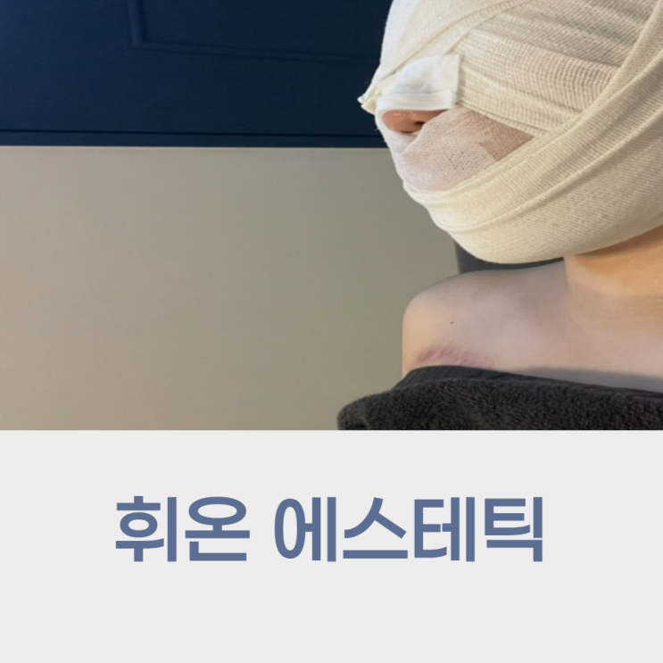 휘온에스테틱 구월점 미라클 관리 솔직후기 ( 구월동웨딩관리, 하이리프)