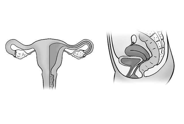 자궁의 위치이상, 전방전위와 후방전위는