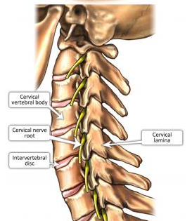 Cervical selective nerve root block (SNRB) : 네이버 블로그