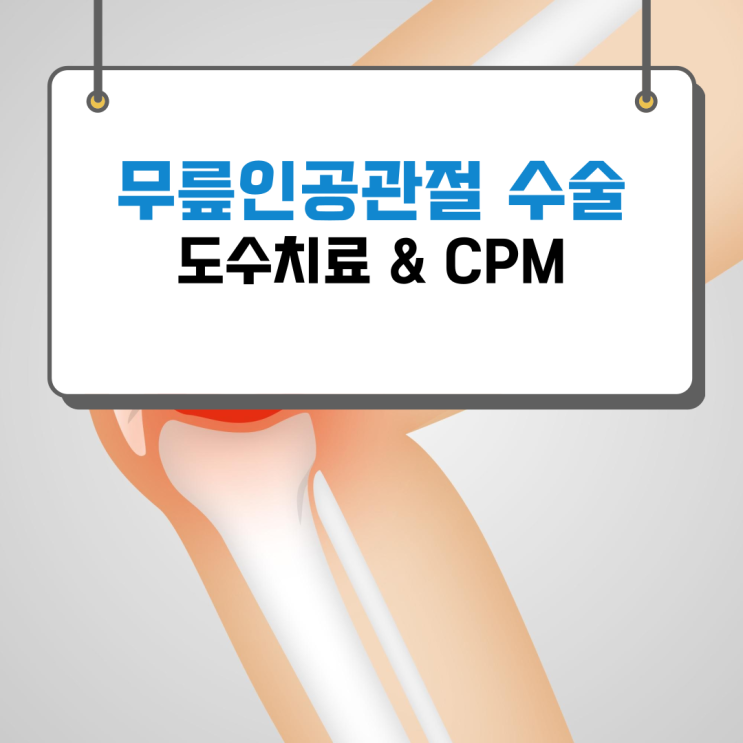  춘천 무릎 인공관절 수술 후 재활 도수치료 & CPM