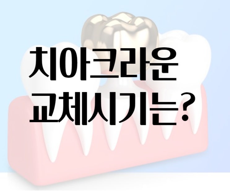 [e맞춤진료] 치아 크라운 교체시기는?