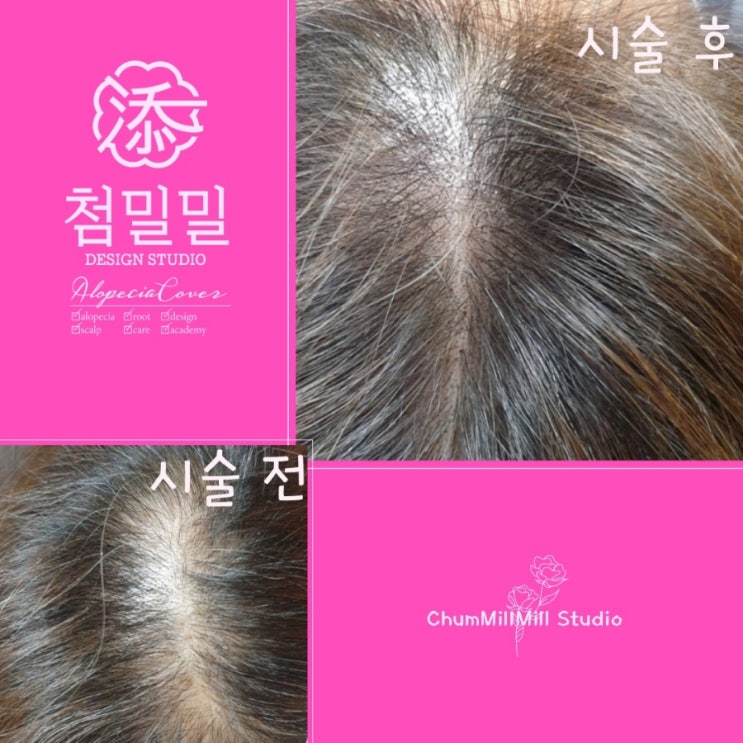 SMP 염색모나 흰머리인데 티나지 않을까? SMP 염색모나 흰머리인데 티나지 않을까?