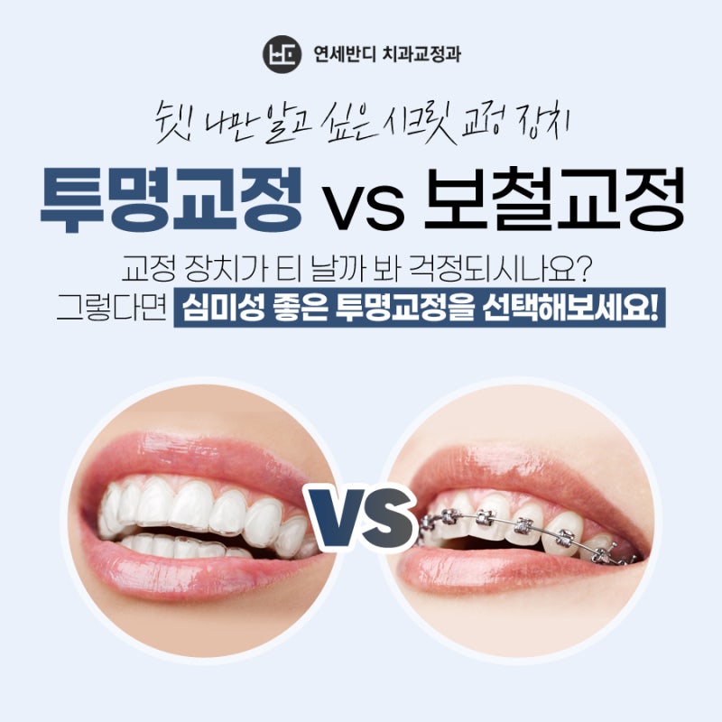 신도림교정은 가지런한 치아로 자신감을 높여드립니다. 신도림교정은 가지런한 치아로 자신감을 높여드립니다.