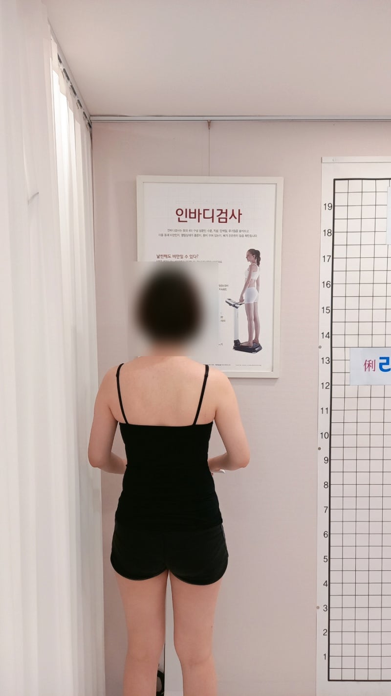 [서초다이어트] 리다이렉트 서초방 등 EMS 하체 집중케어 5