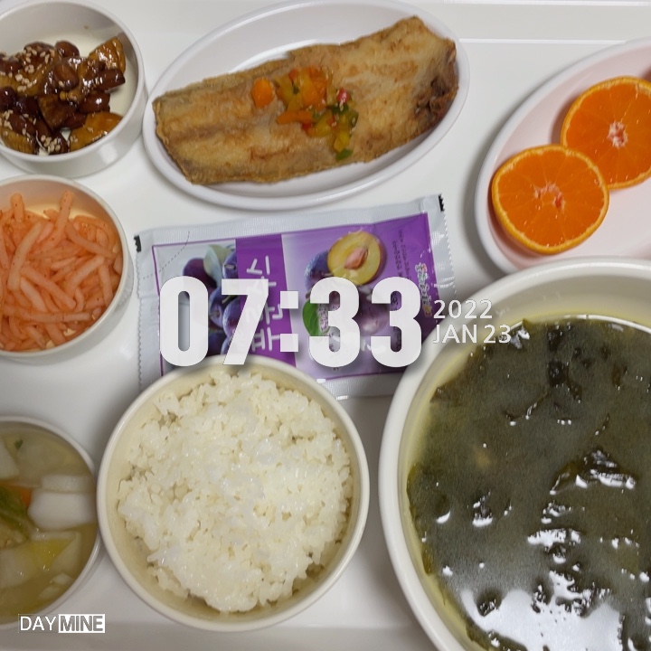  제왕절개 12일차