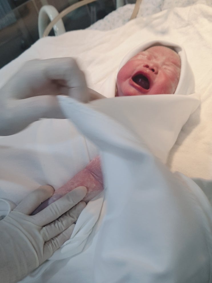  첫째, 둘째 제왕절개 출산 후기 (훗배앓이 극복과 강남 3대 산부인과 미래와 희망 산부인과, 반포 센트리움 조리원 마사지로 산후 붓기 뺀 팁)