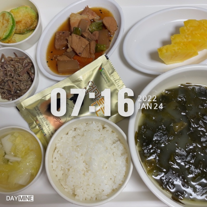  제왕절개 13일차