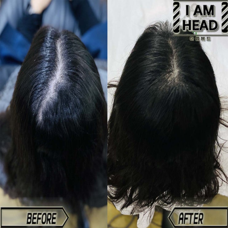  원치않는 가르마 한방에 해결해드립니다! 수원미용실 아엠헤드에서 가르마 모류교정 시술하기 !!