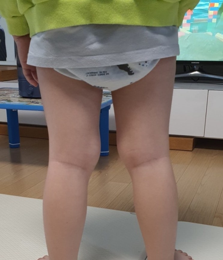  5세 아이 무릎 통증 성장통이길