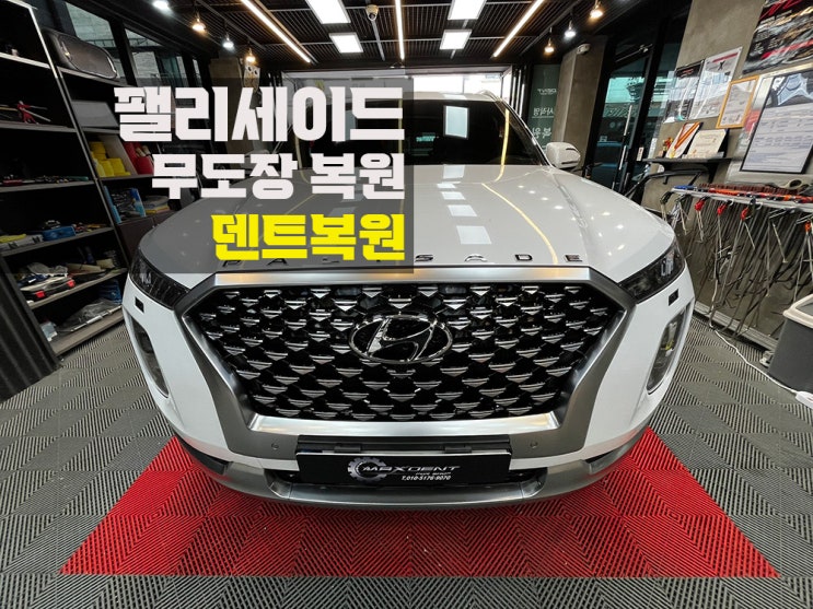  청라덴트 무도장 찌그러짐 복원은 맥스덴트에서.