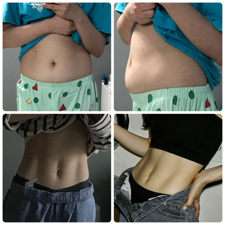  20대 직장인 다이어트 20kg 감량 후기 : 눈바디 편
