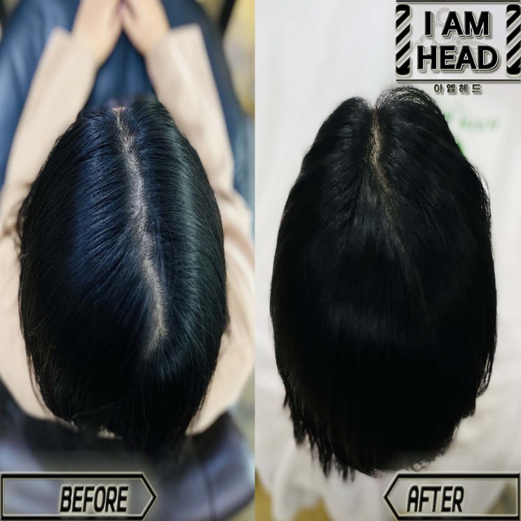  수원미용실 아엠헤드에서 가르마 모류교정 하고 두상성형하기 !!