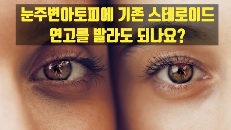  눈주변아토피에 기존 스테로이드 연고를 발라도 되나요?