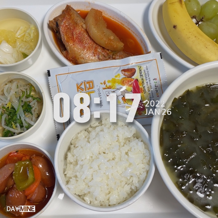  제왕절개 15일차