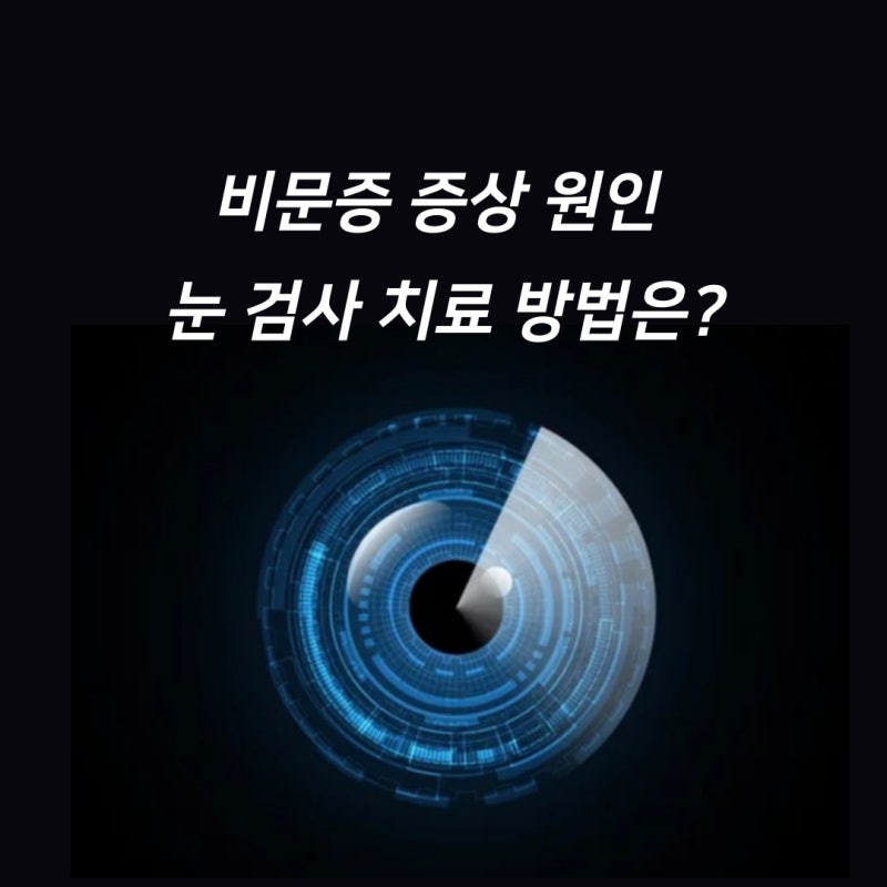 가벼워 보이지 않는 비문증, 치료법은? 가벼워 보이지 않는 비문증, 치료법은?