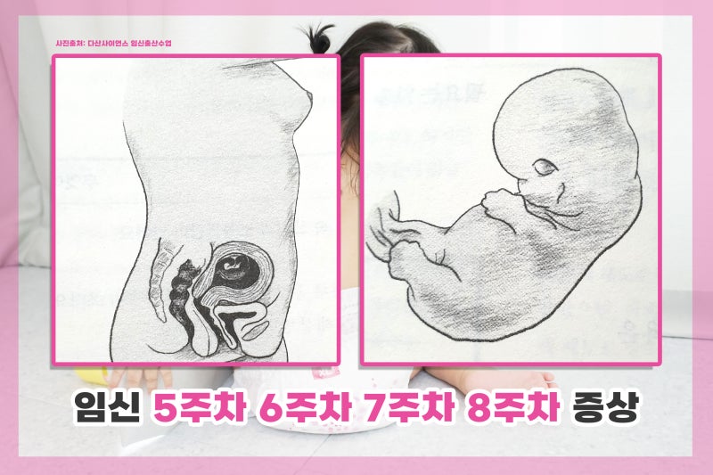4주, 5주, 6주, 7주, 8주 증상, 난황은 언제 임신주머니를 보나요?