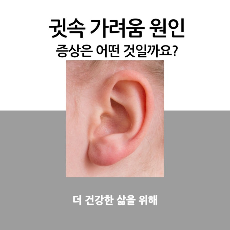 귓속 가려움 원인, 증상은 어떤 것일까요?