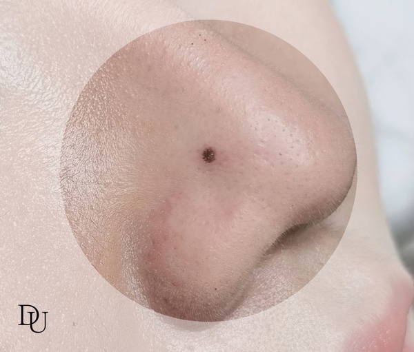 광주 미인점 / 상무지구 미인점 포인트로 딱!