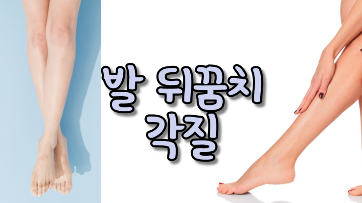  발 뒤꿈치 각질