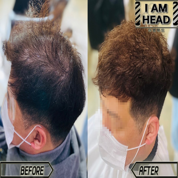  탈모커버 잘하는 링거펌전문점 [수원미용실 아엠헤드]