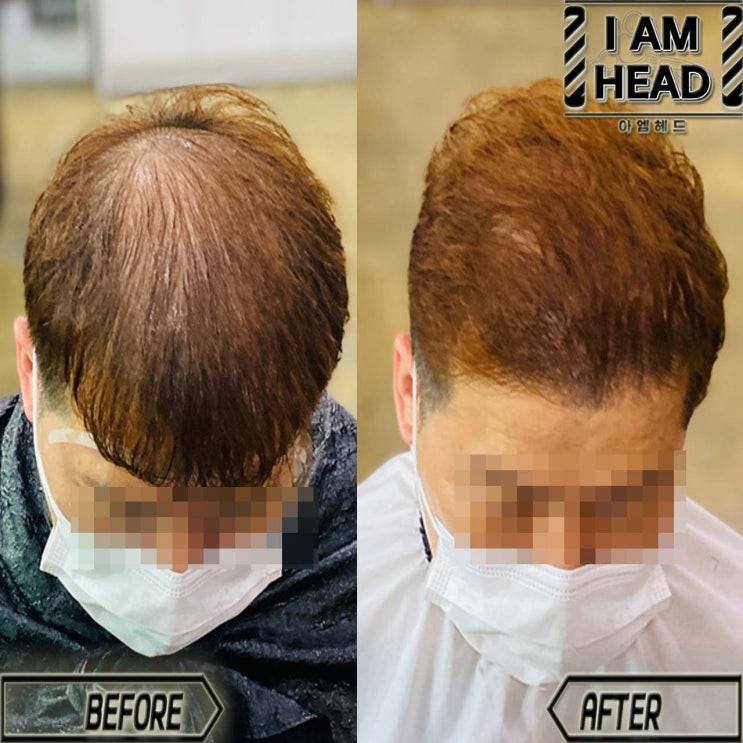  탈모커버 리젠트펌 !!!! 링거펌전문점 수원미용실 아엠헤드 !!