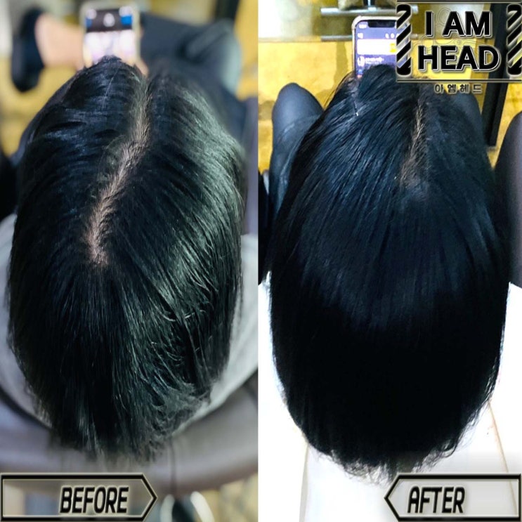  갈라지는 가르마 교정 잘하는 링거펌전문점 수원미용실 아엠헤드 !!