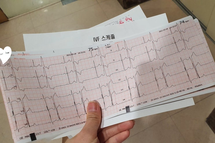  심장일기 1) 심장, 큰 병원으로 가라구요?!