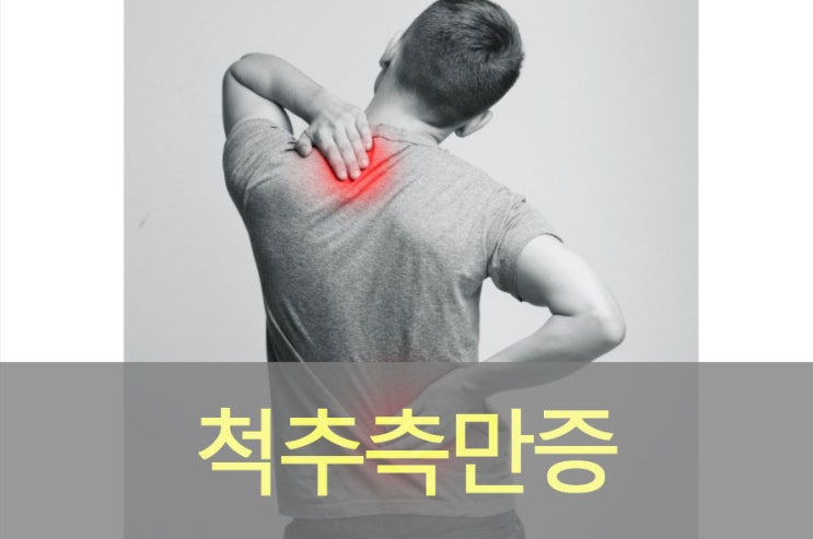  이외로 모르는 척추 측만증 원인과 증상, 예방, 운동, 교정