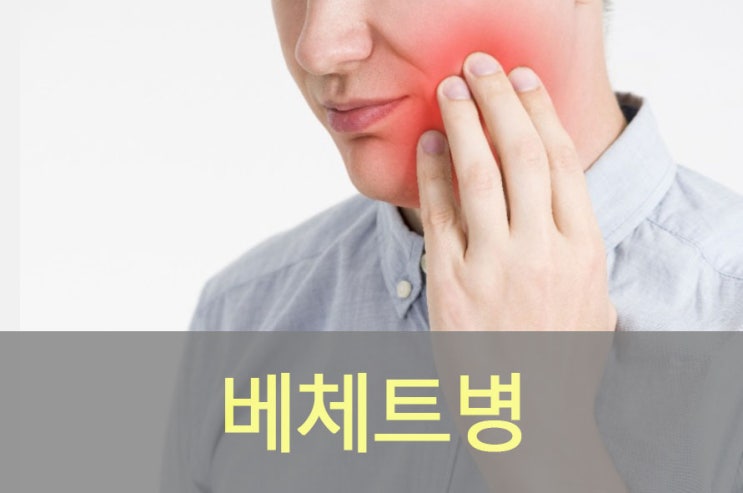  자가면역질환 베체트병 원인과 증상, 만성염증질환