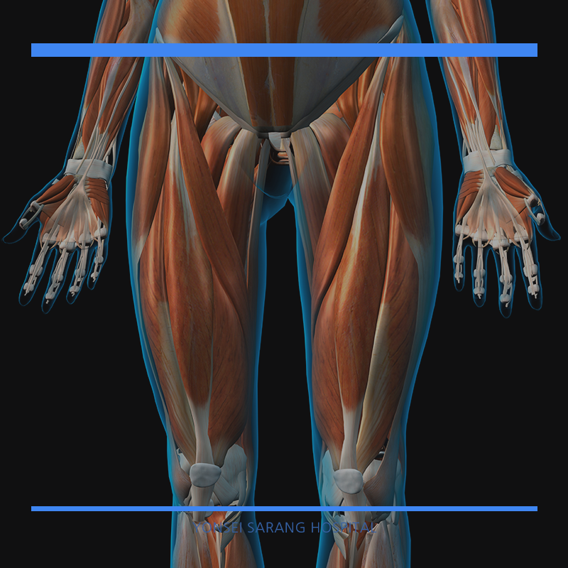 허벅지 근육통의 이유