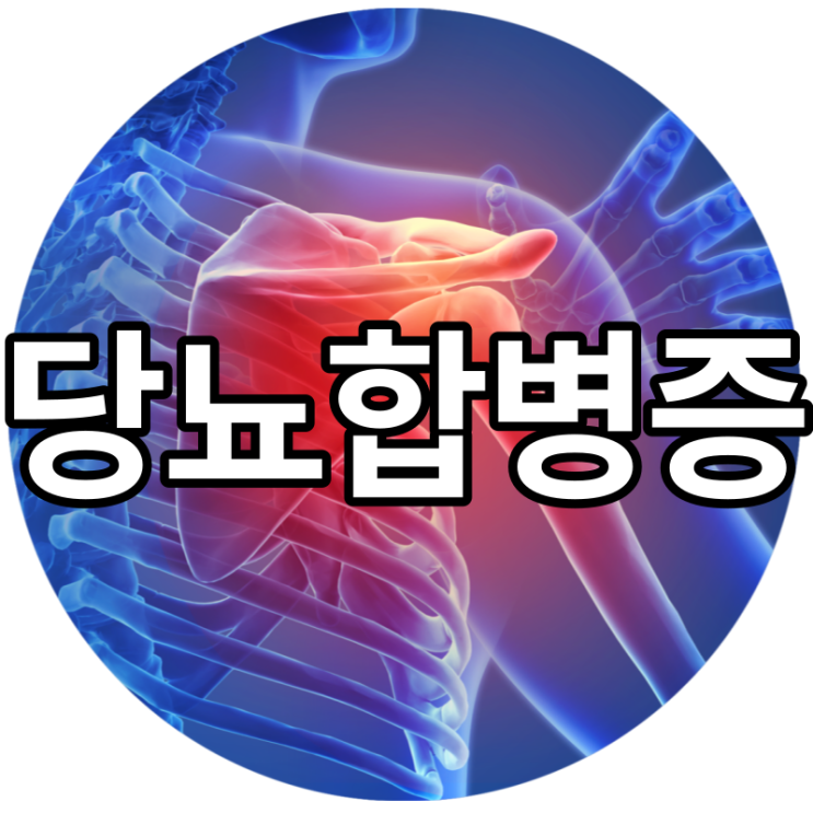  당뇨 합병증당뇨병 합병증당뇨 합병증 증상 족부궤양 눈 검사!