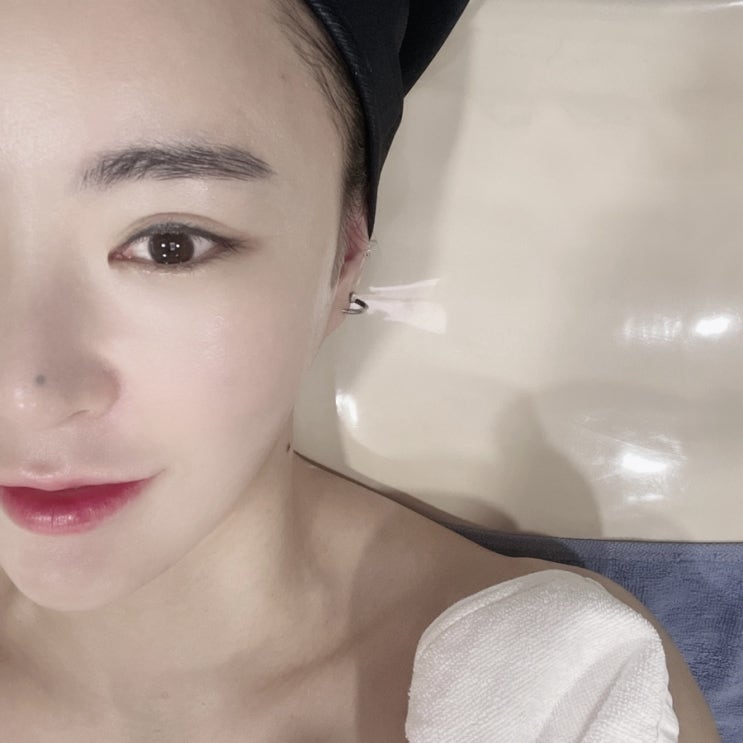  구리피부관리 미플, 얼굴붉은기와 피부미백을 위한 알마퀸즈관리