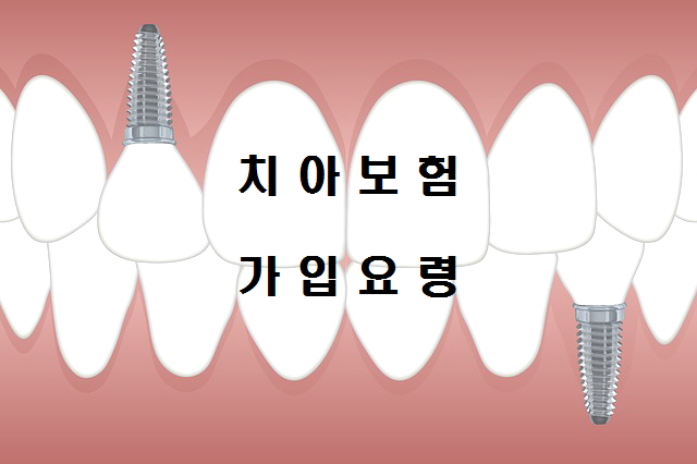  보험정보 치아보험(치과보험), 치아건강보험, 임플란트보험 가입 꿀팁